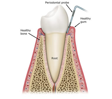 Diagram of healthy gums